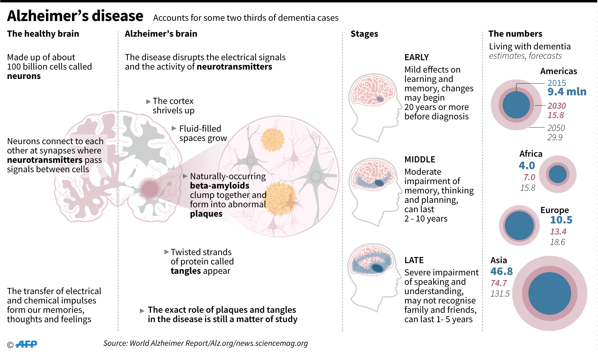Alzheimers Disease and Dementia Research Highlights From 