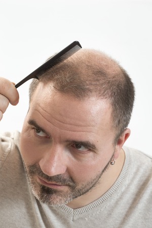 50266247 - 40s man with an incipient baldness doing hair with background