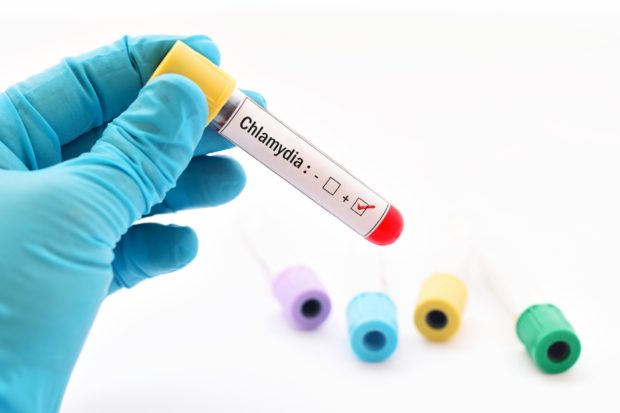 Blood sample positive with Chlamydia