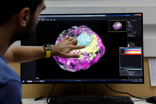 A model of an early-stage human embryo, created by Israeli scientists without using an egg, sperm or womb