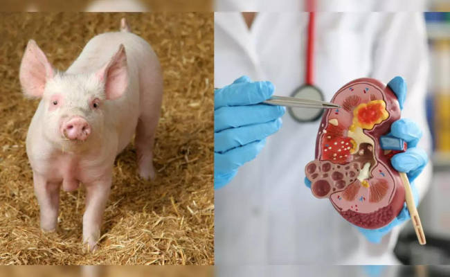 Scientists created humanized kidneys in pigs | Inquirer Technology