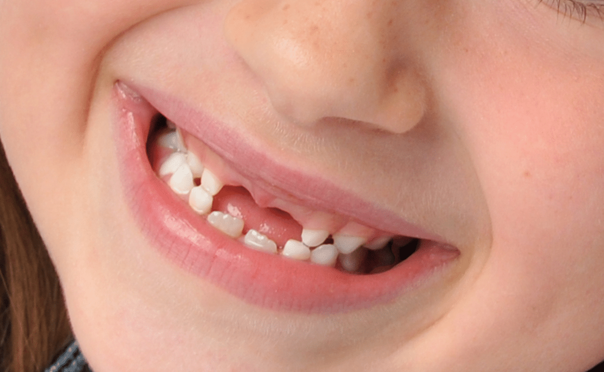 Japanese researchers test pioneering drug to regrow teeth